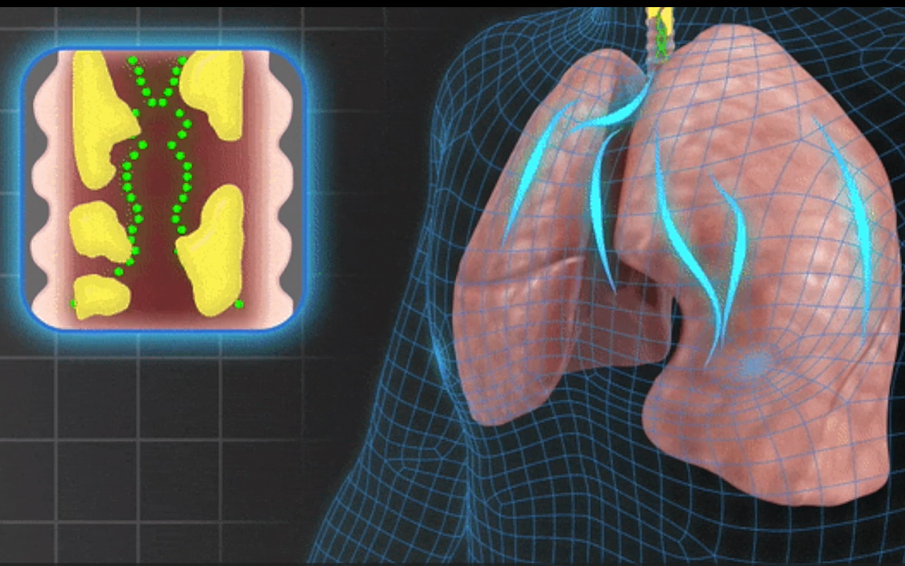 Herbal Respiratory Wellness